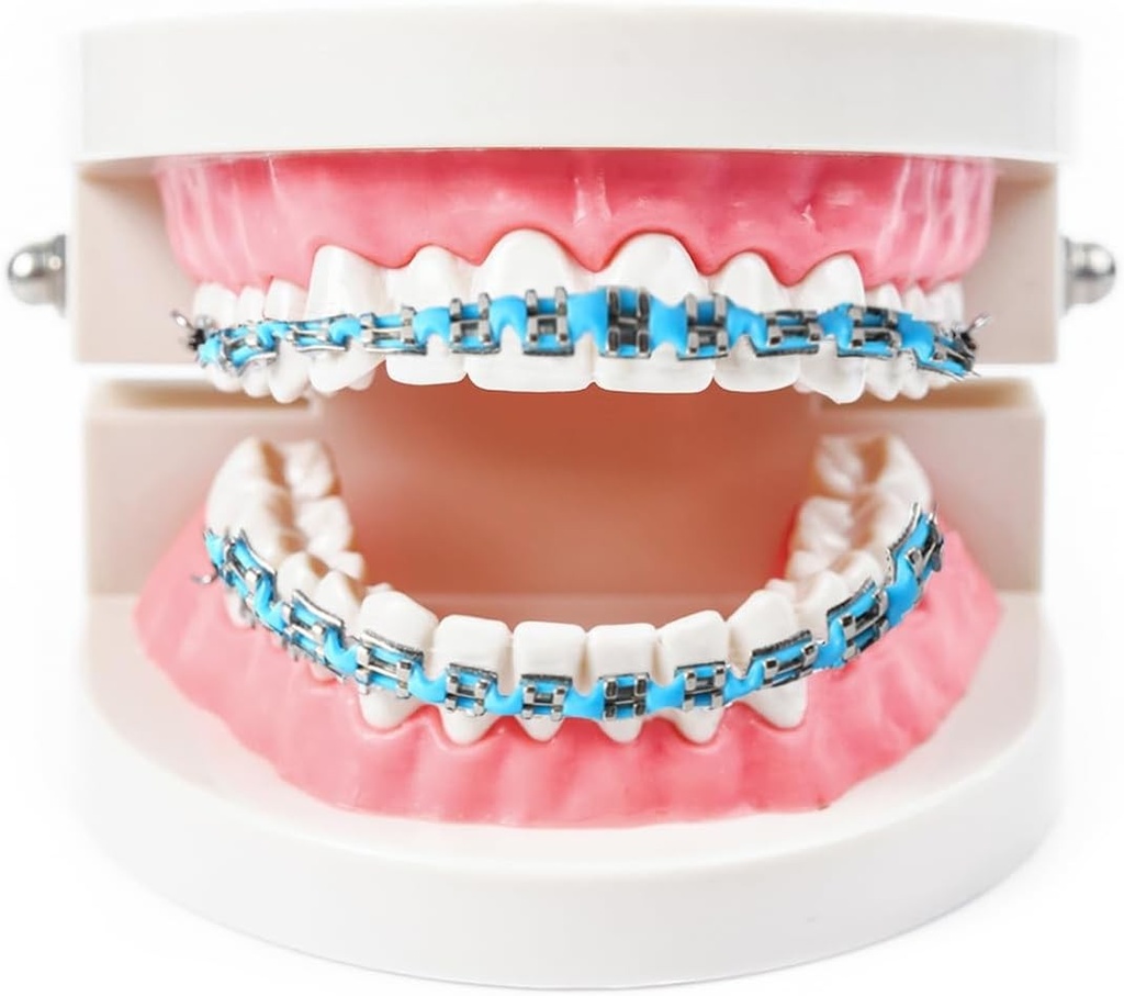 Aparate dentare false, aparate dentare, aparate dentare false, fatete cu clips, dinti cu clips, proteze dentare cu clips, fatete (albastru deschis)